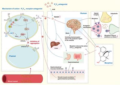 Analgesic drug use in patients with STEMI: Current perspectives and challenges